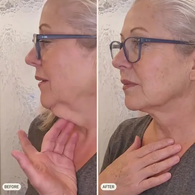 Susan K. — before and after 90 days