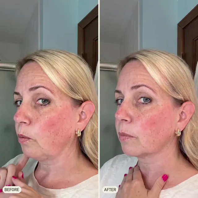 Lucia F. — before and after 90 days