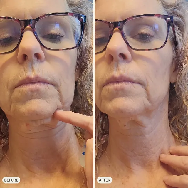 Faye D. — before and after 90 days