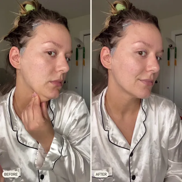 Diane M. — before and after 90 days