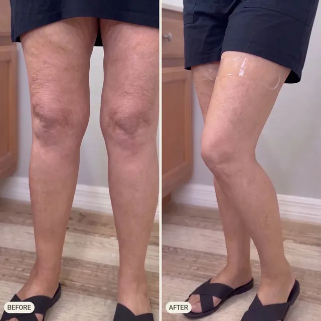 Sharon R. — before and after 90 days
