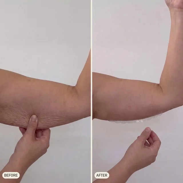 Wanda S. — before and after 90 days
