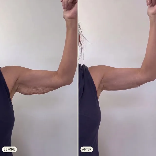 Gail D. — before and after 90 days