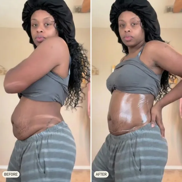 Dana W. — before and after 90 days