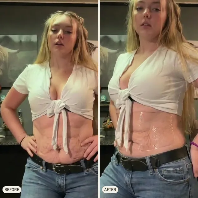 Elena R. — before and after 90 days