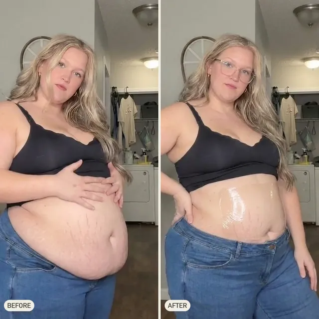 Bree D. — before and after 90 days